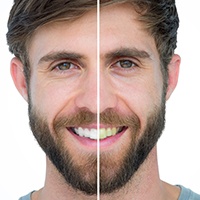 Cost of cosmetic dentistry in Aurora