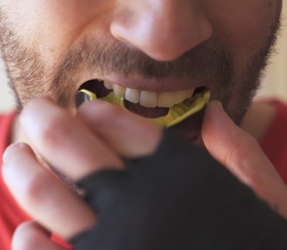 Man inserting a mouthguard 