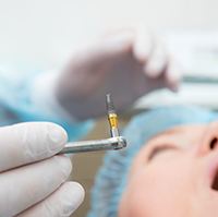 Dental implant surgery