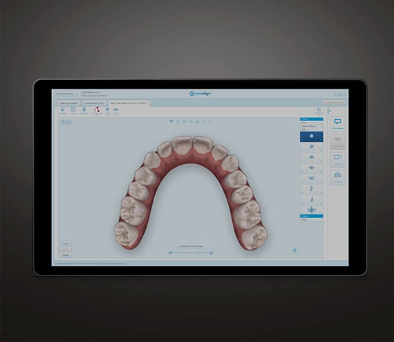 Clear Aligners program on computer screen