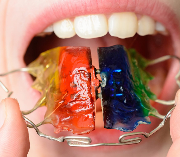 expander