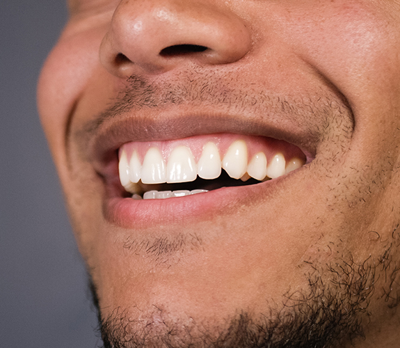 Close up of man's smile