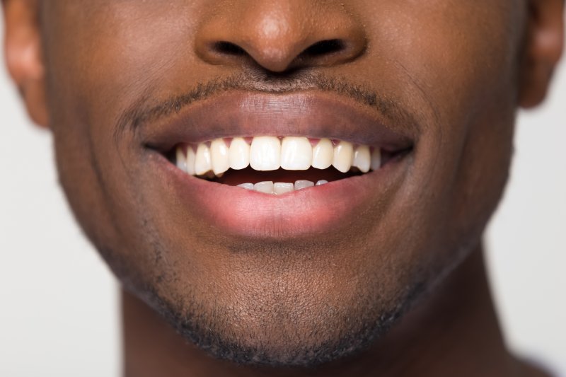 Close-up of smile with perfectly straight teeth