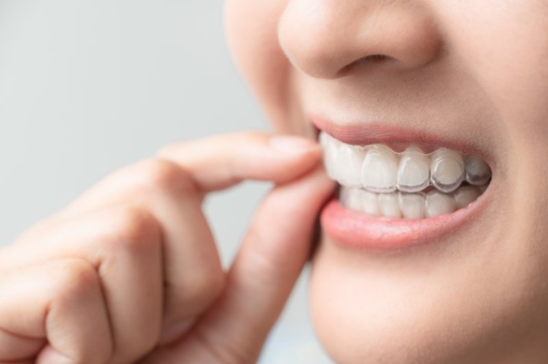 a woman wearing Invisalign 