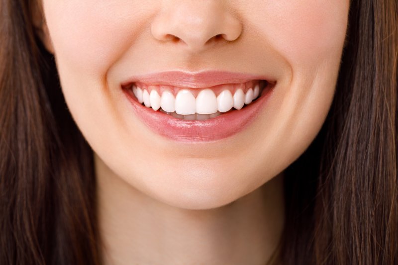 up-close view of a woman’s veneers