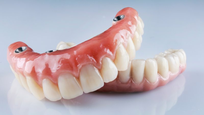 full set of implant dentures